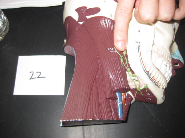 <p>Body Systems</p><p>Lab Image 1-29</p>