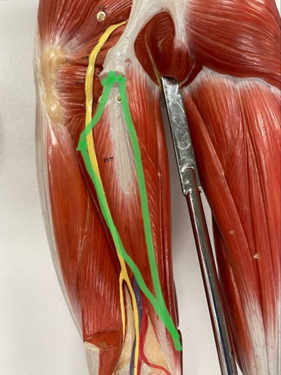<p>O: ischial tuberosity of ischium</p><p>I: medial condyle of tibia</p><p>A: flexes knee</p>