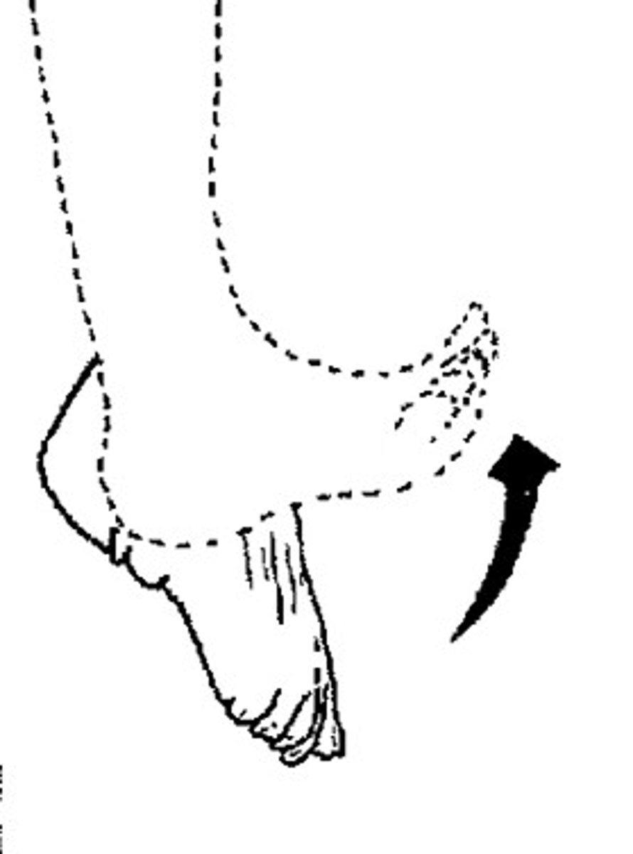 <p>movement of the foot dorsally (point toes up)</p>