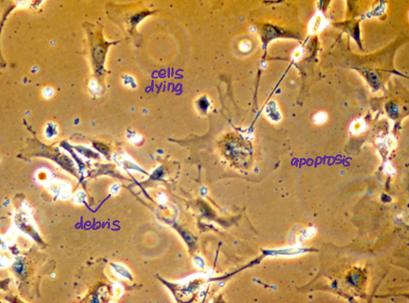 <p>State when cells <strong>lose telomeres </strong>of adequate length, resulting in end-to-end fusion of chromosomes, genetic chaos and widespread apoptosis.</p>