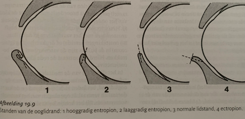 <ul><li><p>Functioneren:</p><ul><li><p>Ooglidreflex</p><ul><li><p>Tik zachtjes/voorzichtig op het ooglid</p></li></ul></li></ul></li><li><p>Lengte oogspleet (macroblepharon, microblepharon)</p></li><li><p>Buitenzijde ooglid → inspectie en palpatie</p><ul><li><p>Verwondingen</p></li><li><p>Kaalheid</p></li><li><p>Zwelling</p></li><li><p>Vochtigheid</p></li></ul></li><li><p>Ooglidrand</p><ul><li><p>Normaal: gepigmenteerd, glad, glanzend, onbehaard, droog, 2-3mm (onder) tot 1mm (boven) breed</p></li><li><p>Distichiasis: haren op de ooglidrand</p></li><li><p>Congenitaal ontbrekende delen (aplasia palpebrae of coloboma)</p></li><li><p>Verkregen defecten (trauma, ontsteking, neoplasie)</p></li></ul></li><li><p>Stand van het ooglid</p><ul><li><p>Normaal: sluit goed op de kromming van de oogrand aan</p></li><li><p>Entropionproef</p><ol><li><p>Pak een plooi van de onderooglid huid, ongeveer 1,5cm ventraal van de laterale canthus.</p></li><li><p>Plaats de plooi met de behaarde zijde tegen de cornea aan</p></li><li><p>Na het loslaten knippert de hond het direct weg</p></li></ol></li></ul></li></ul>