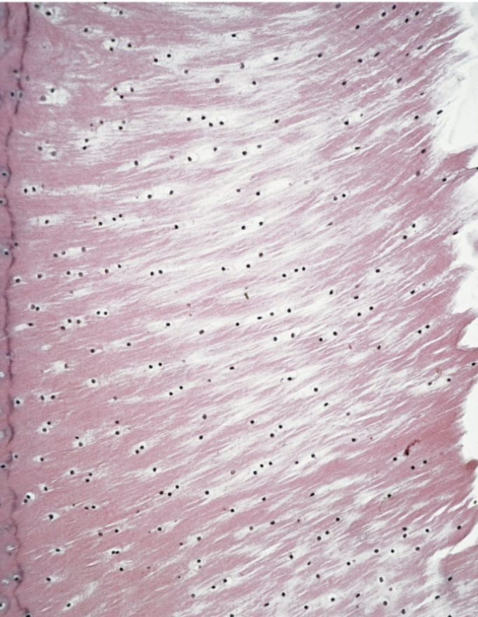 <p>What is the arrow point at?</p>