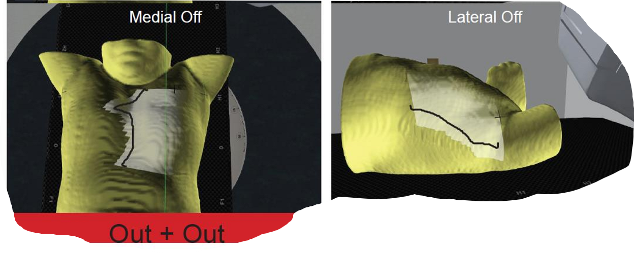 <p>if our field light is “out + out”, what two things is it telling us about our isocenter</p>