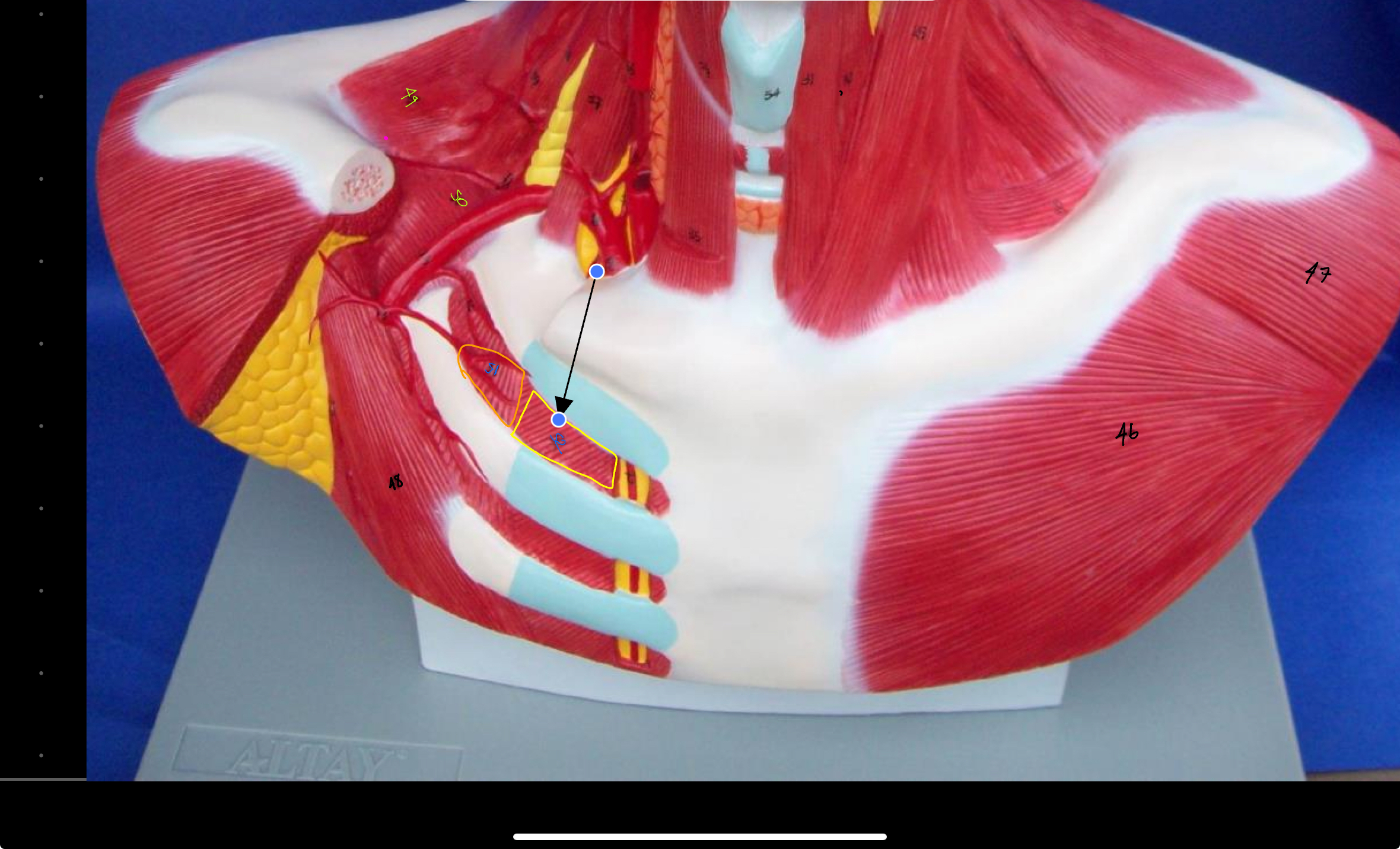 <p>What type of muscle is this ( altay model )</p>