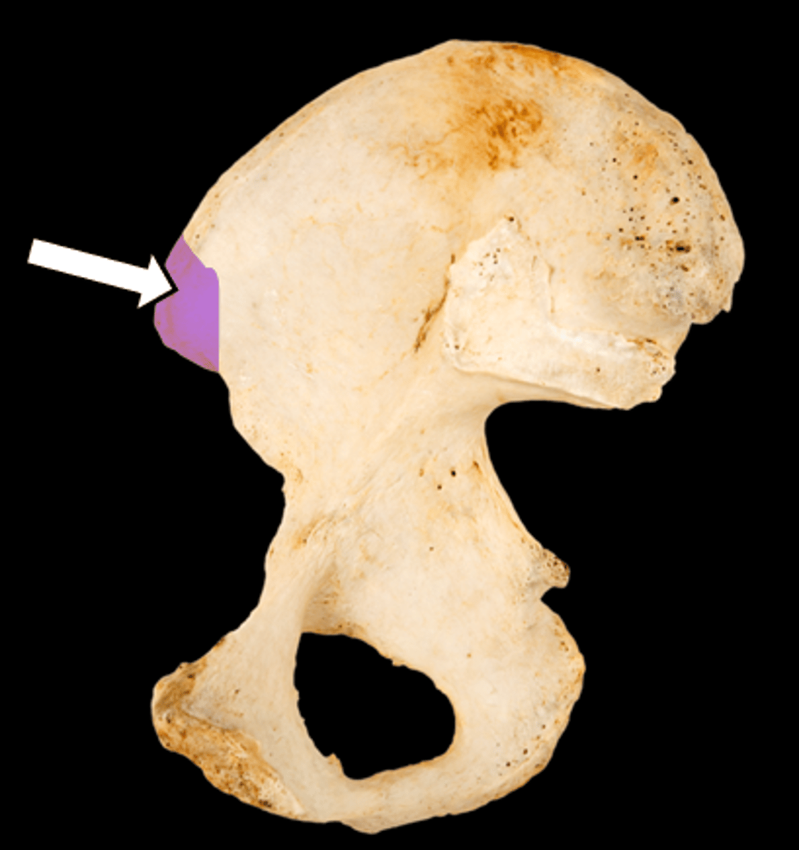 <p>name the part</p>