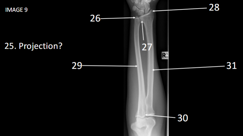 <p>What Projection is this</p>