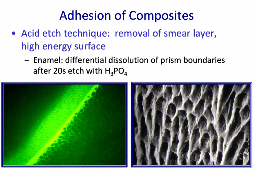 <p><strong>Acid etch technique:</strong> removal of smear layer, high energy surface</p><p>formation of a honeycomb layer within the enamel which is then infiltrated with the resin&nbsp;</p><p>– Enamel: differential dissolution of prism boundaries after 20s etch with H3PO4</p>