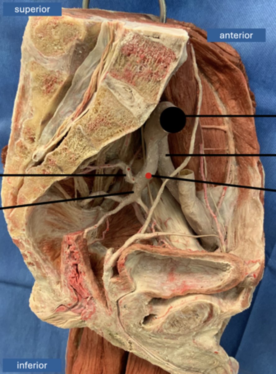 <p>artery</p>