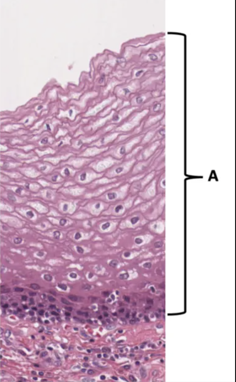 Is this a cutaneous or mucous membrane?: