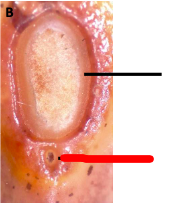 <p>What is depicted here in this pinto bean without coat removed?</p>