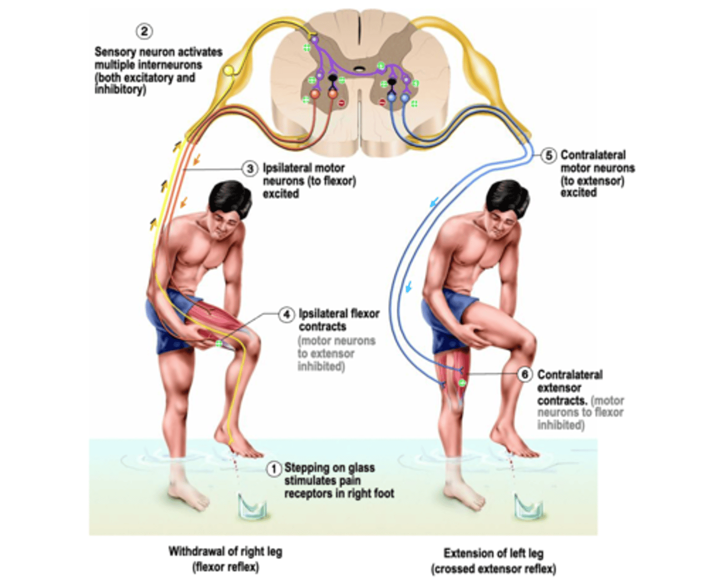 <p>Crossed extensor reflex</p>