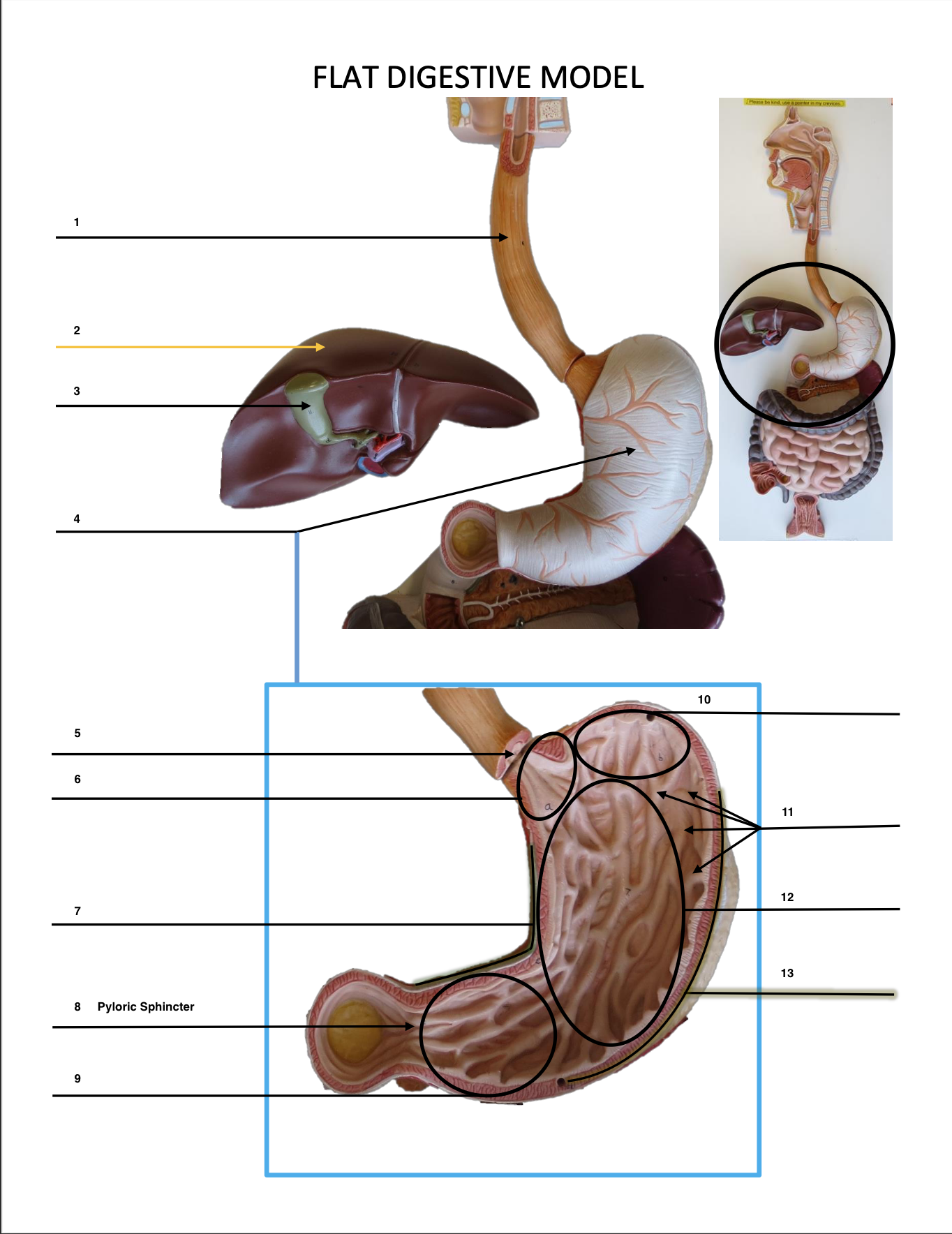 <p>Pyloric Sphincter</p>