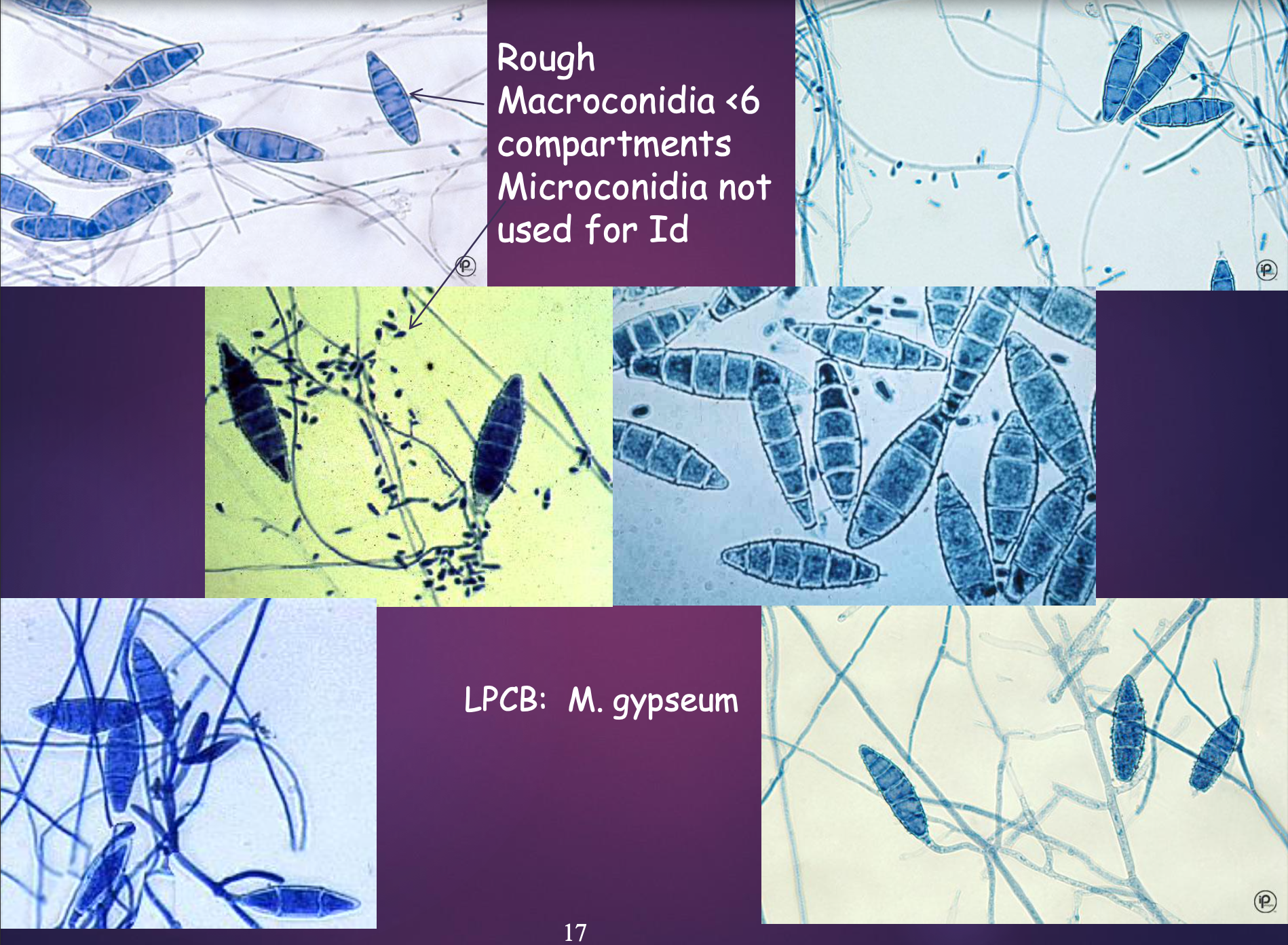 <p>Microsporum Gypseum - Macroconidia</p>