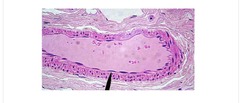 -Single layer
of flat cells
-Allows for rapid exchange
FOUND- lungs, amnion around embryo