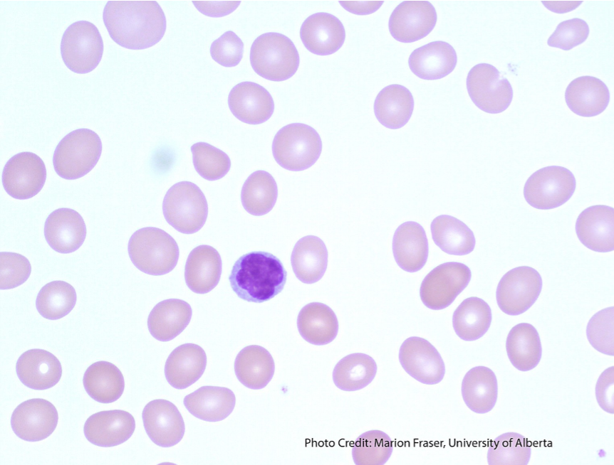 <p>are these cells normocytic, microcytic, or macrocytic?</p>