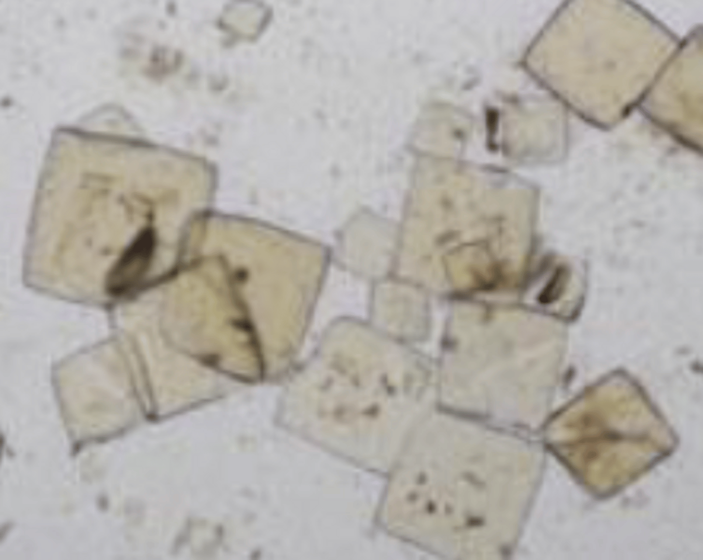 <p>- Diamond or rhomboid shape</p><p>- Yellow to yellow-brown in color</p><p>- Not common in dogs in cats except for dalmations</p>