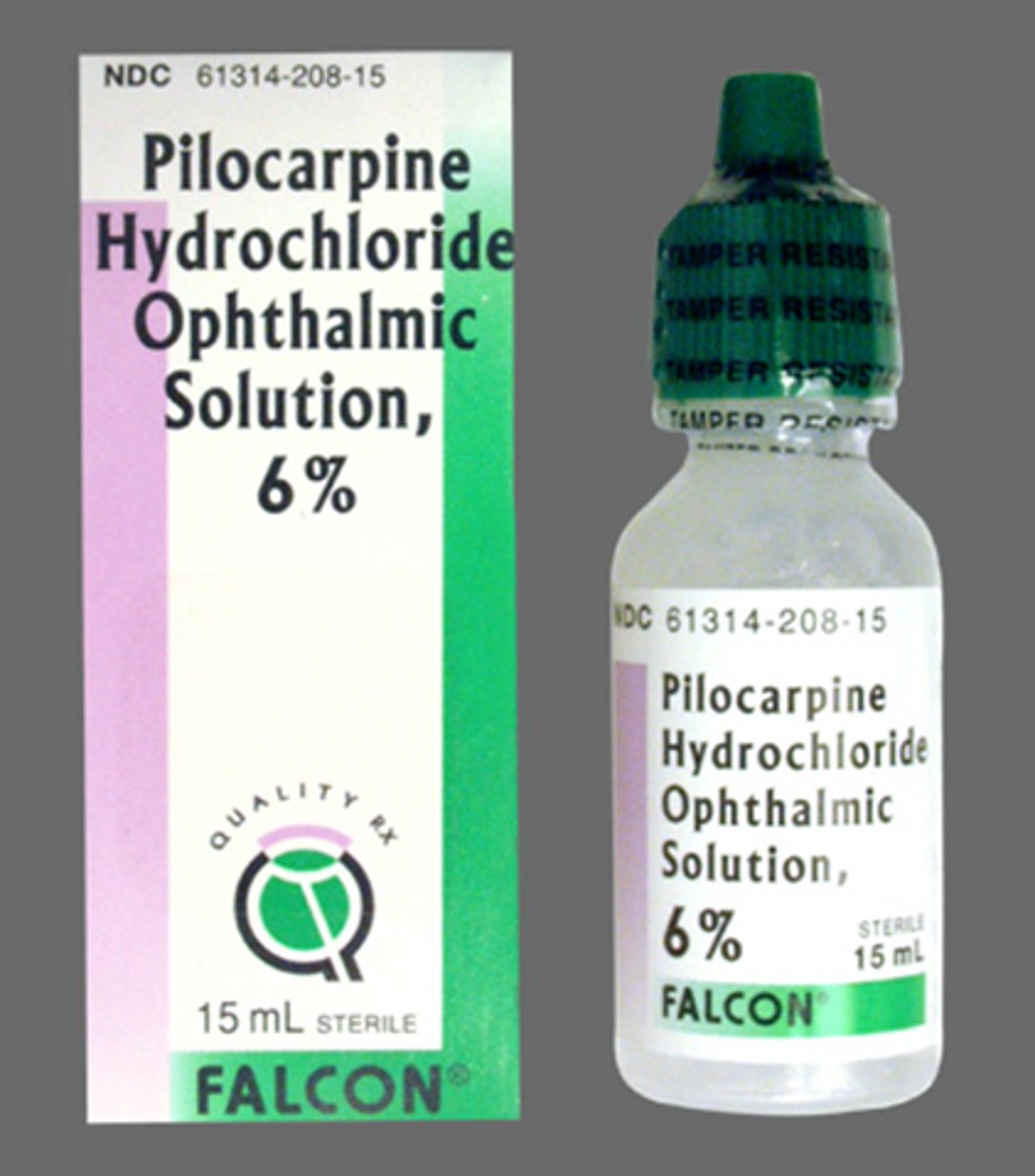 <p>miosis</p><p>accom spasm = blur</p><p>HA</p><p>conj hyperemia</p><p>RD (esp high myopes)</p><p>AC shallowing due to iris diaphragm moving forward</p><p>BAB breakdown</p>