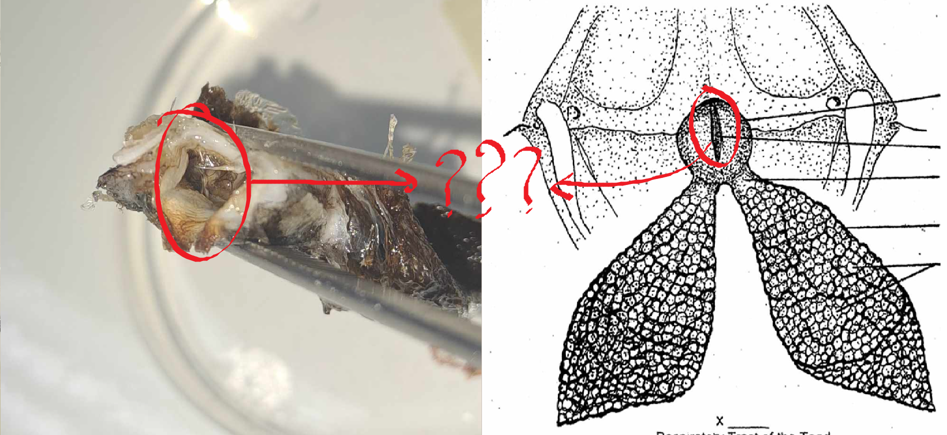 <p>a slit opening of the larynx</p>