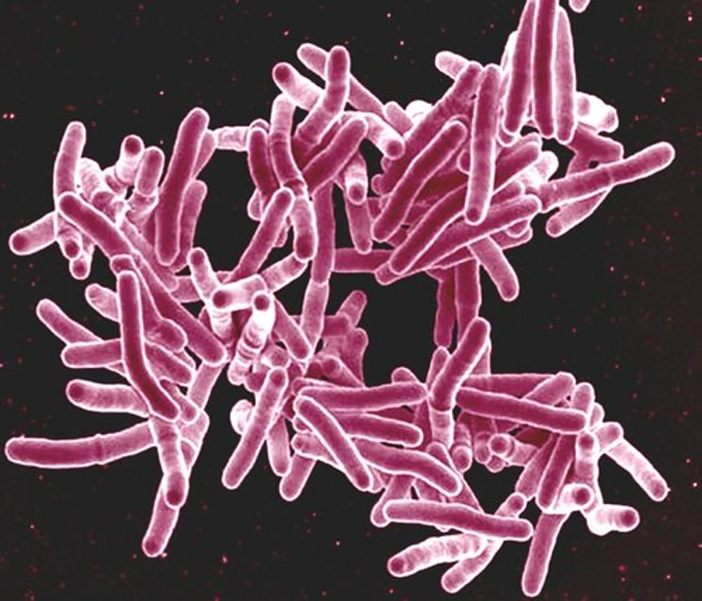 <p>Kingdom of unicellular prokaryotes whose cell walls do not contain peptidoglycan. These bacteria live in extreme conditions (hot springs, acidic, high salt content, guts of ruminant animals)</p>