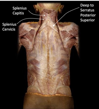 <p>splenius capitis, splenius cervicis</p>