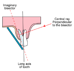 <img src="https://knowt-user-attachments.s3.amazonaws.com/f52dfb87-1b78-4cdf-be3e-cf10cc708f53.png" data-width="100%" data-align="center"><ul><li><p>the central ray meets the bisector angle (dotted line) at a 90 degree angle</p></li></ul><p></p>