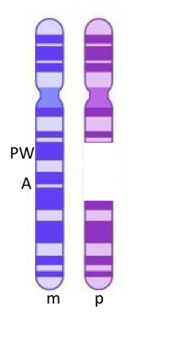 <p>prader-willi <br><br>on maternal chromosome, PW is methylated/off and A is on</p>