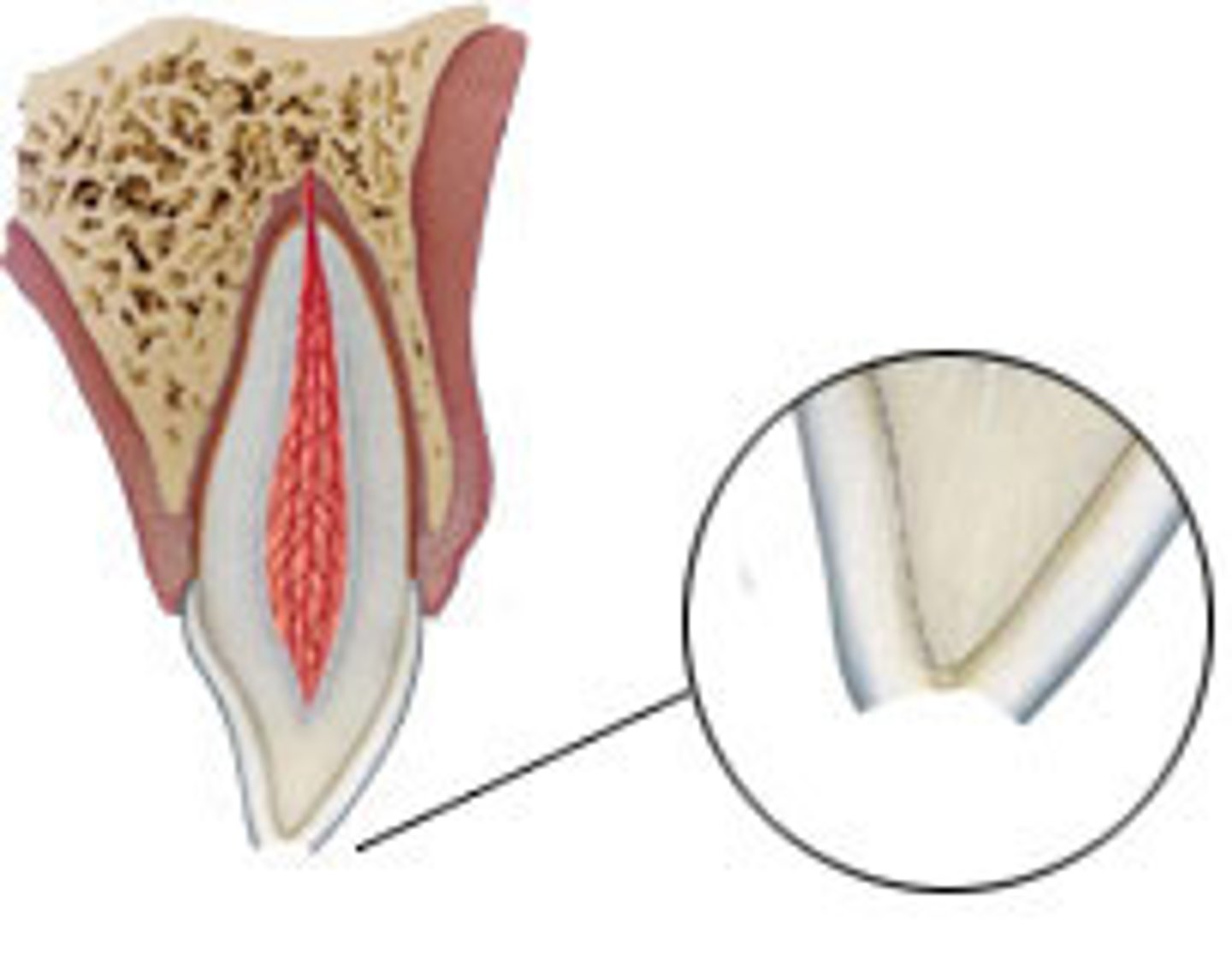 <p>fracture confined to the enamel</p>