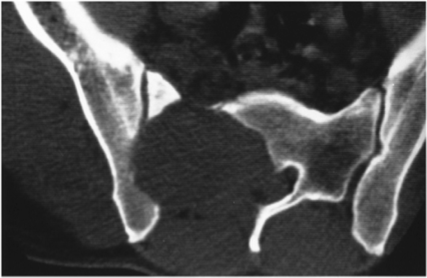 <p>Used for sensitive/specific bone detail</p>