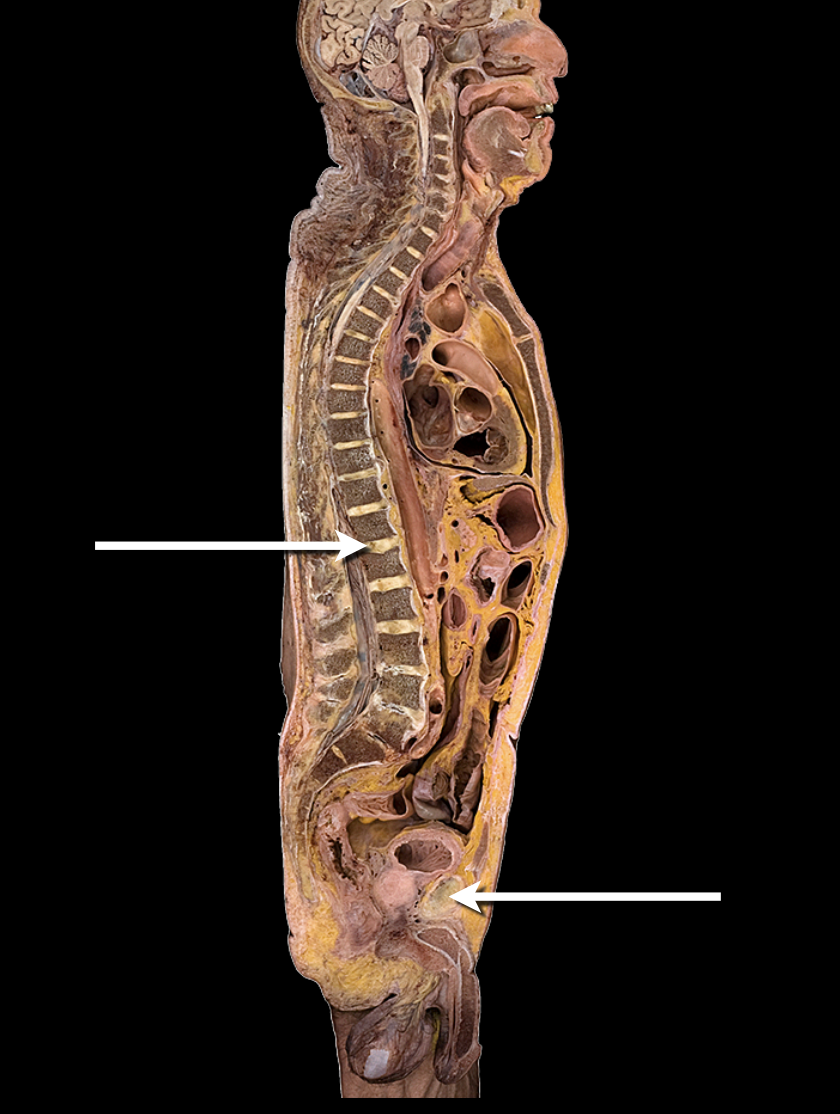 <p>What type of joint and subtype</p>