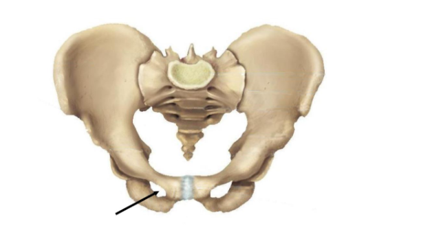 The opening indicated in the figure is the