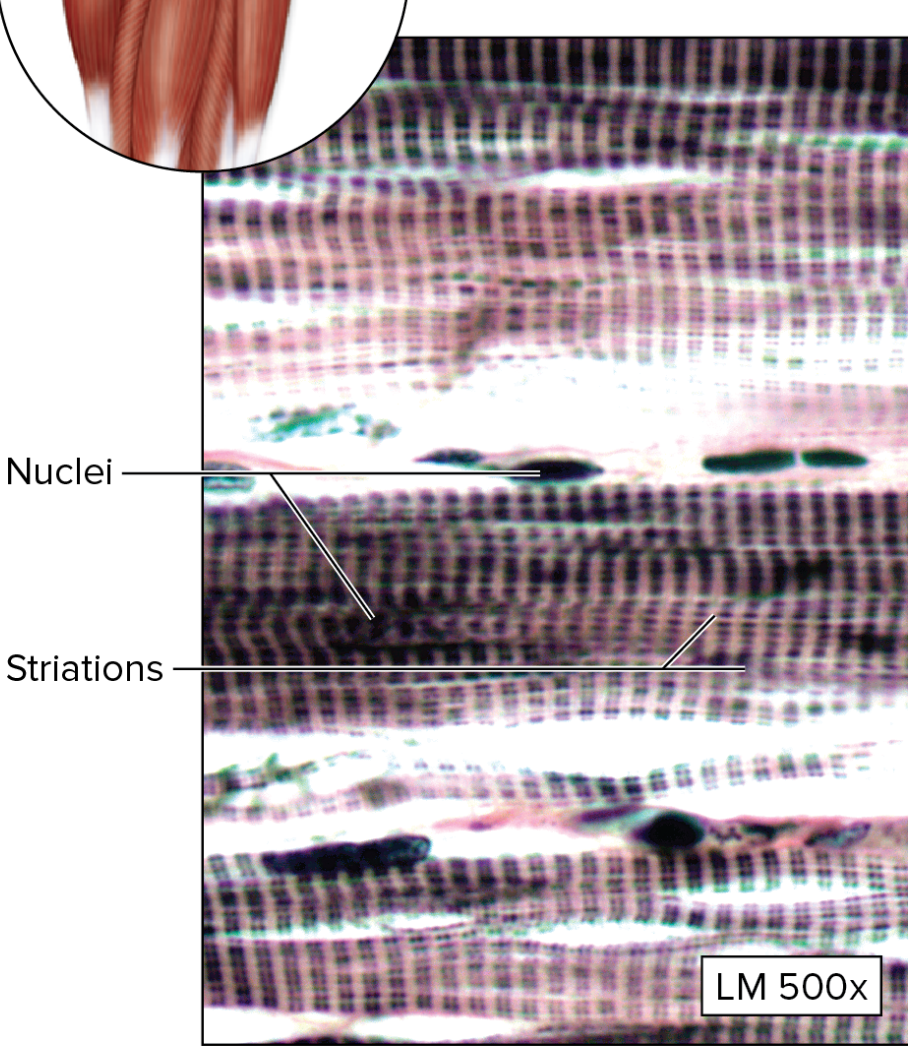 <p>What type of muscular tissue is this?</p>