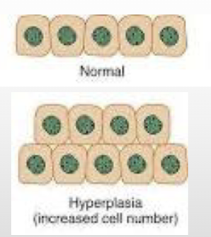 <p><span>Increase in the number of cells in an organ that stems from increased proliferation (Can be physiologic or pathologic)</span></p>