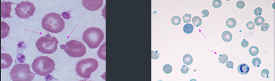 <p>What these?</p><p>how form?</p><p>Appearance in stains?</p>