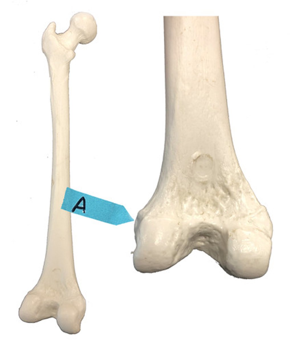 <p>Identify this bone marking.</p>