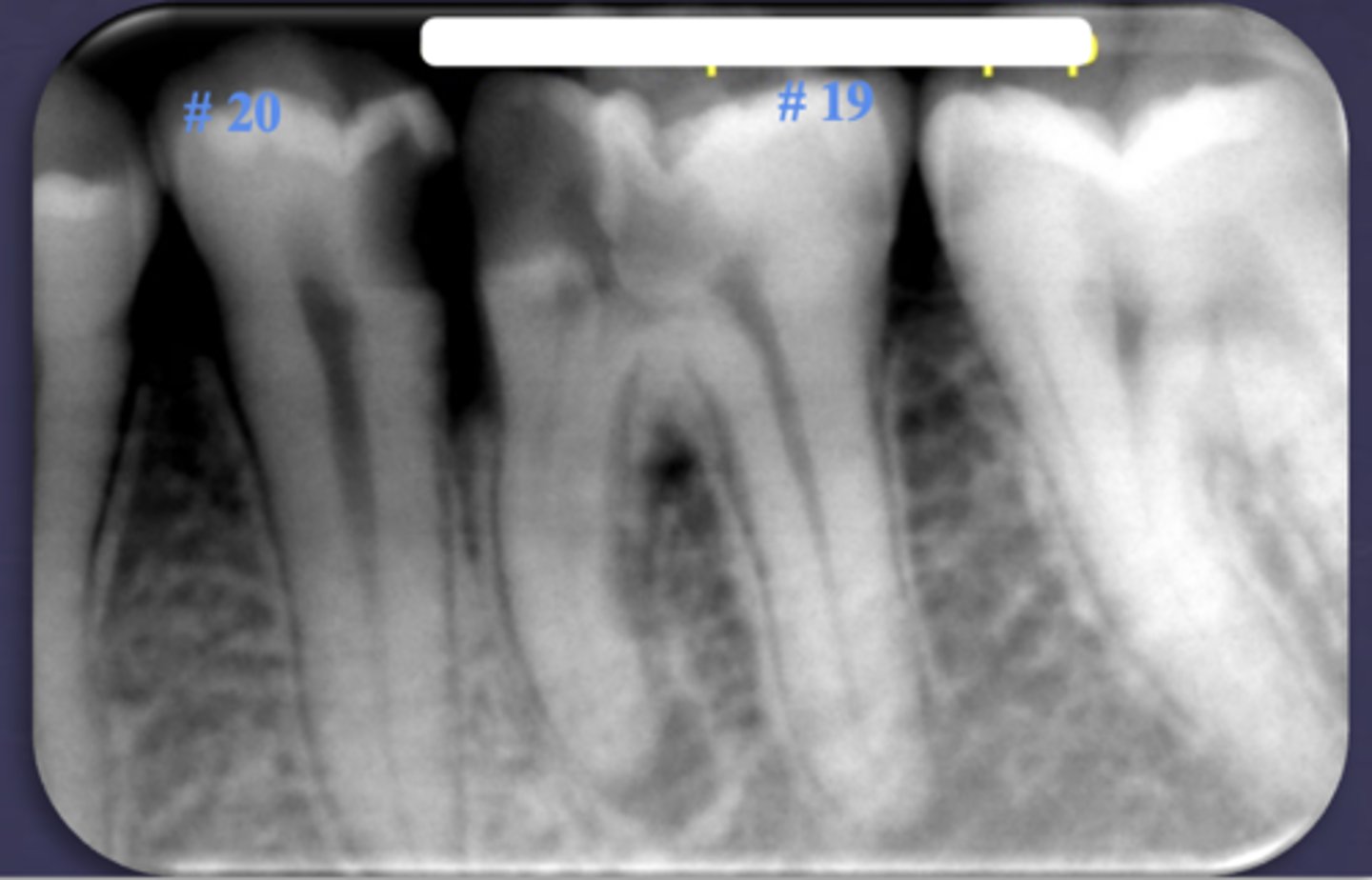 <p>ID the condition:</p>