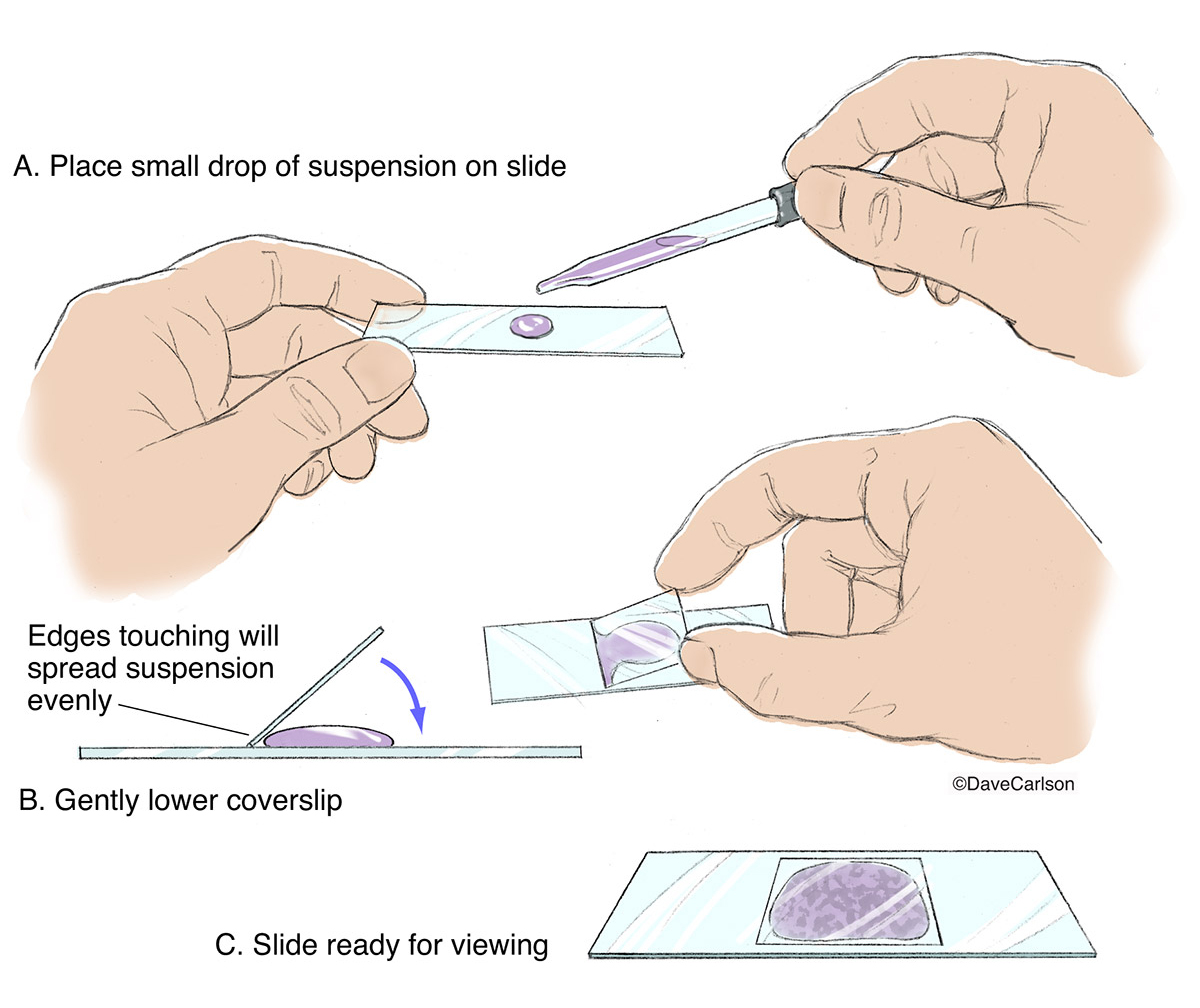 <p>suspended cells are placed between a glass slide and cover slip </p><p>cells are living and locomotion can be observed</p>