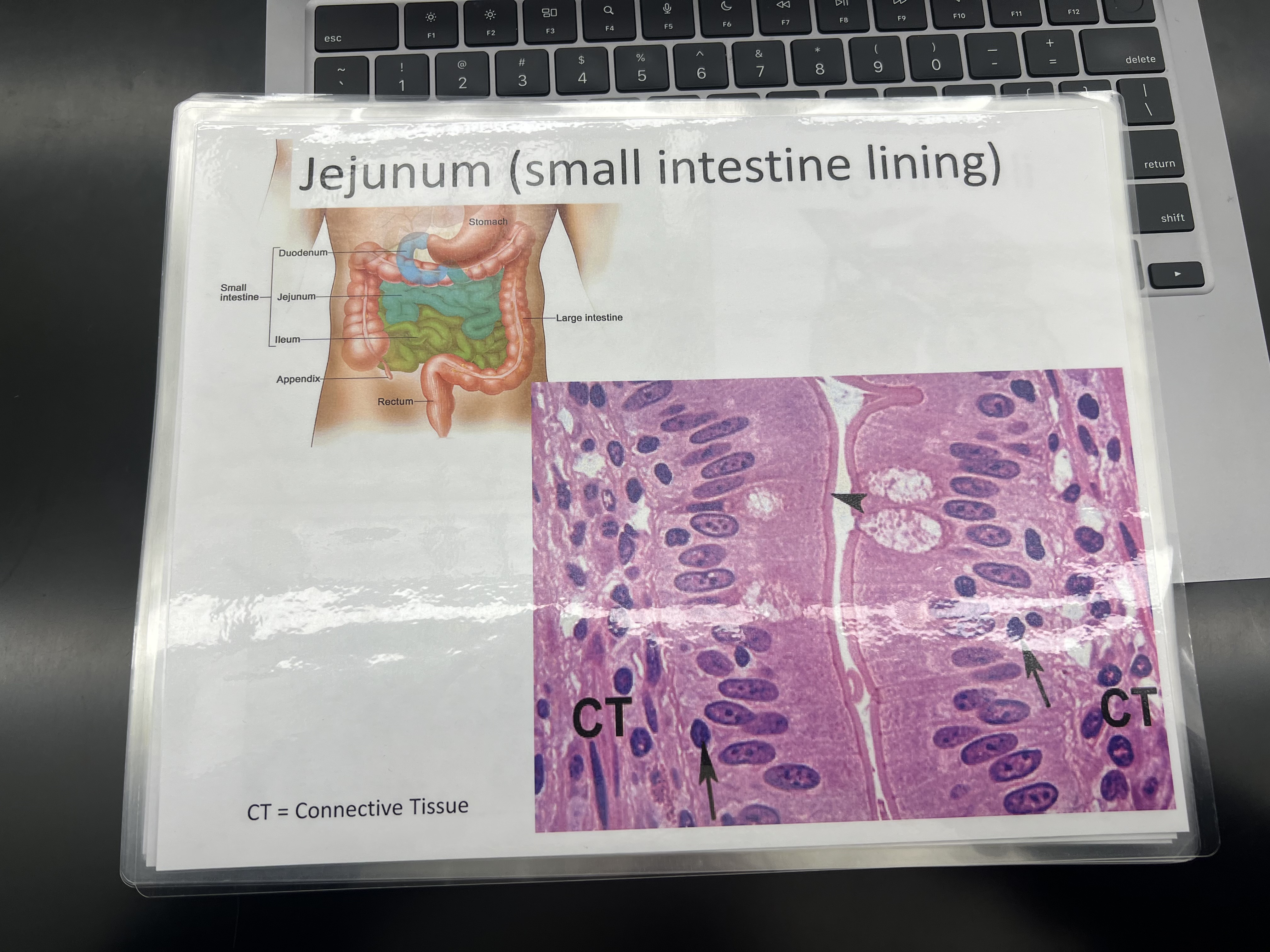 <p>LOCATIONS: Lining of the stomach, intestine, gallbladder, uterine tubes, and collecting</p><p>ducts of the kidneys</p><p>FUNCTIONS: Protection, secretion, absorption</p><p>structure: single layer of all rectangular cells.</p>