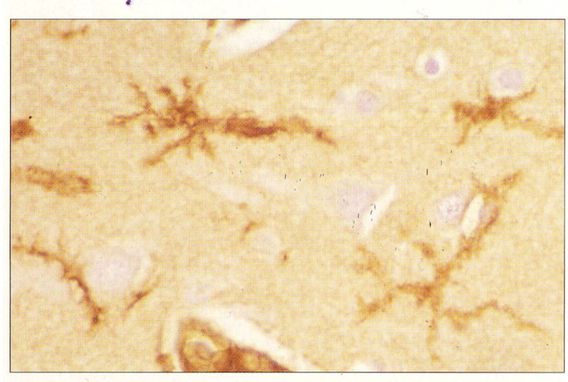 <p>forme générale dendritiques trè ramifiée et très fin (prolongements pour communication et forme un réseau de la cerveau et la moelle épinière)</p><p>noyau dense en forme de bâtonnets</p>