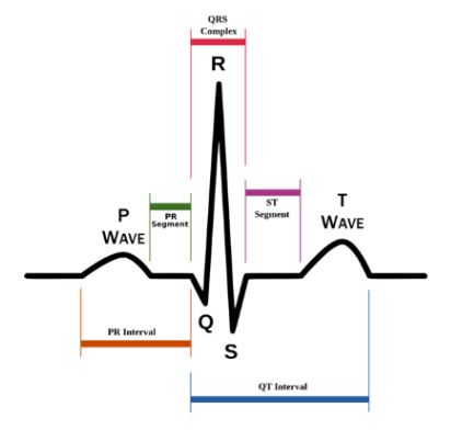 <p>QRS Complex</p>