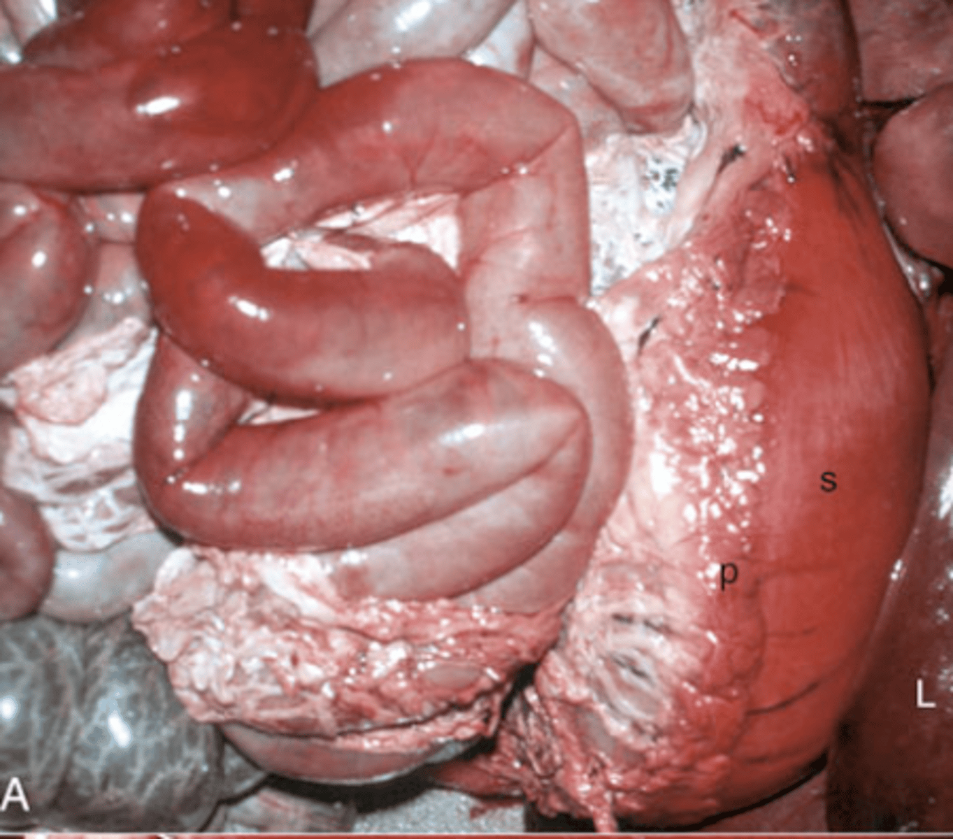 <p>What type of imbibition is shown in this image?</p><p>Hemoglobin or Bile?</p>