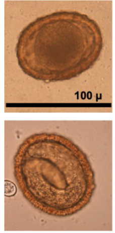<p>Host</p><ul><li><p>Racoons </p></li></ul><p>Adult worms → SI </p><p>Zoonoses</p><ul><li><p>YES,  widespread geographically </p></li></ul><p>Pathogenesis and signs </p><ul><li><p>Nonpathogenic in racoons </p></li><li><p><span style="background-color: transparent;"><span>The larvae (not adults) occur in humans (and other mammals and birds) where they are one of several causative agents of "larval migrans".</span></span></p></li><li><p><span style="background-color: transparent;"><span>Outbreaks of fatal central nervous system disease (NLM) caused by B. procyonis have occurred on farms and in zoos and research animal colonies and natural infections have also been recognized in several species.</span></span></p></li></ul><p>Diagnosis and treatment</p><ul><li><p>Identification of parasite eggs in feces</p></li><li><p>No effective therapy for incidental hosts, anthelmintics slow down or kill exposed larvae as they migrate. Prevention important!!!</p><ul><li><p>Eggs has thick shell that protects from most disinfectants. Best way to rid of contaminated soil or area is flaming it. </p></li></ul></li></ul><p></p>