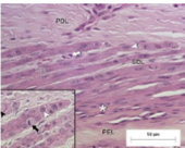 <p>what type of laminitis does this show </p>