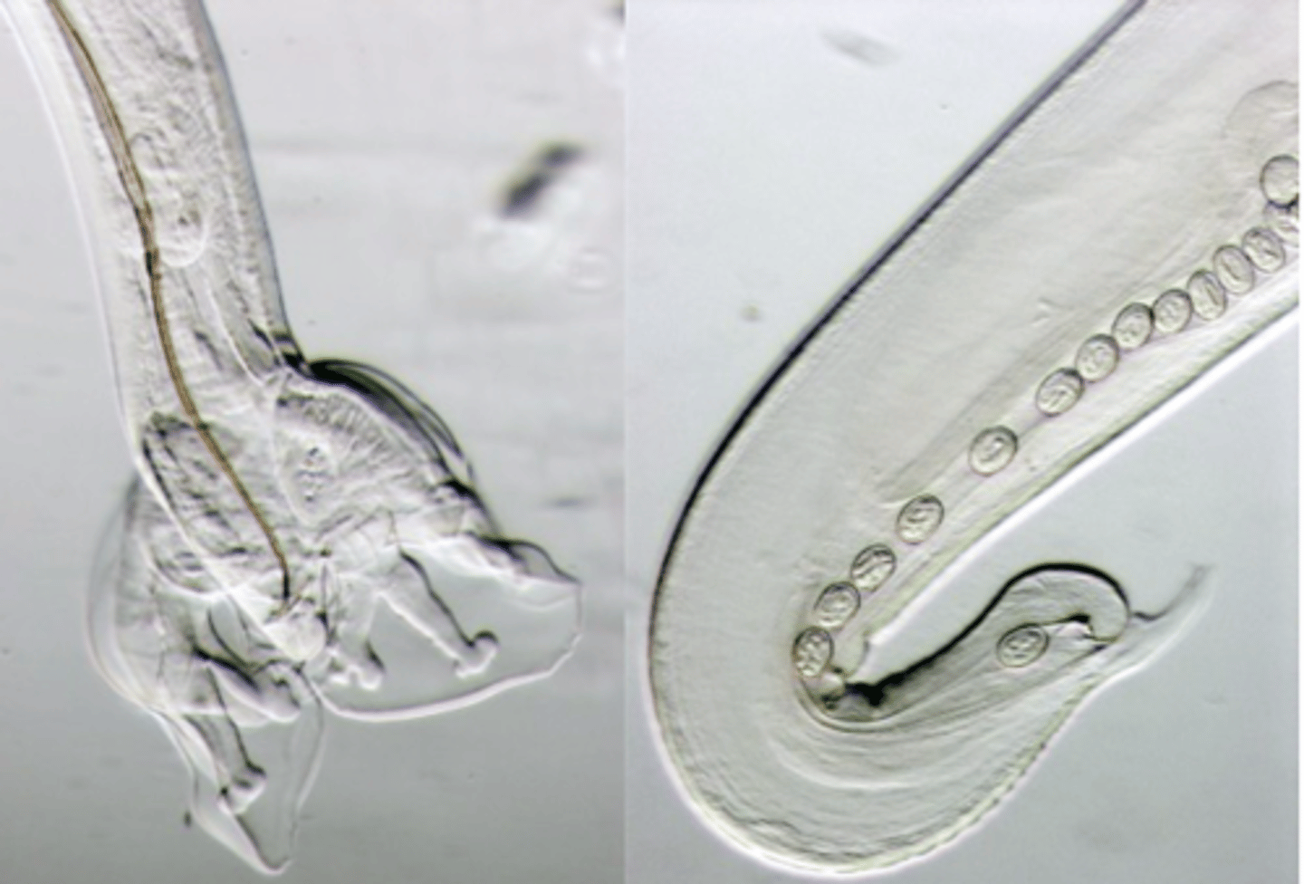 <p>Adult worms</p><p>White, filiform body;</p><p>Mouth with 2 trilobed lips;</p><p>Bursal rays of specific shape (some end in swellings);</p><p>The spicules are long and transversally striated;</p><p>The posterior end of the female appears digitiform (prevulvar swelling);</p>