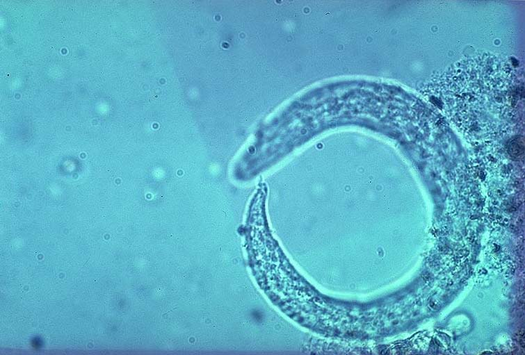 <p>filaroides osleri</p>