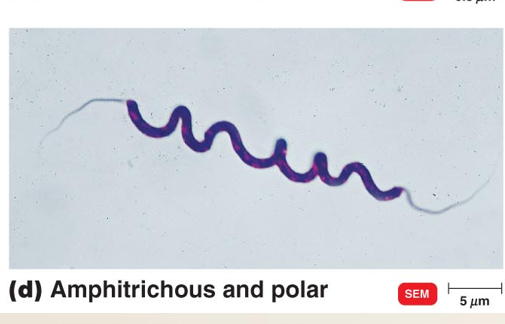 <p>Arrangements of Bacterial Falgella </p>