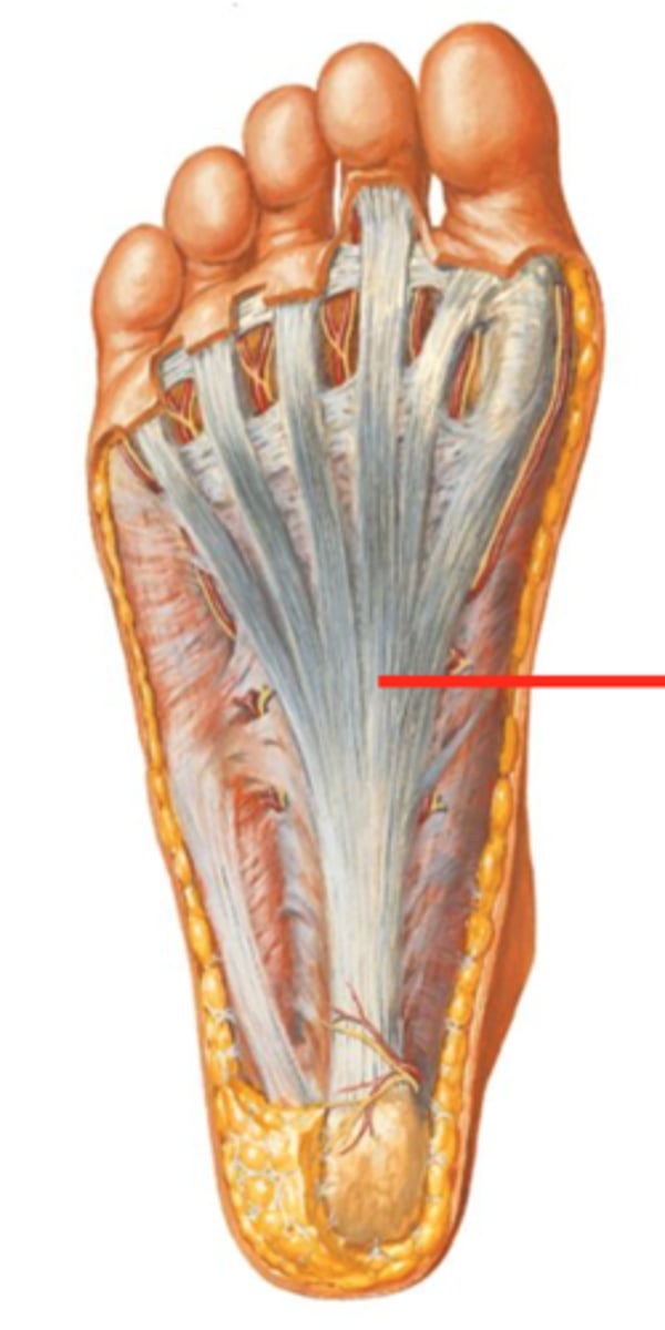 <p>thickening of the plantar fascia, similar to that found in the palm of the hand</p><p>acts</p>
