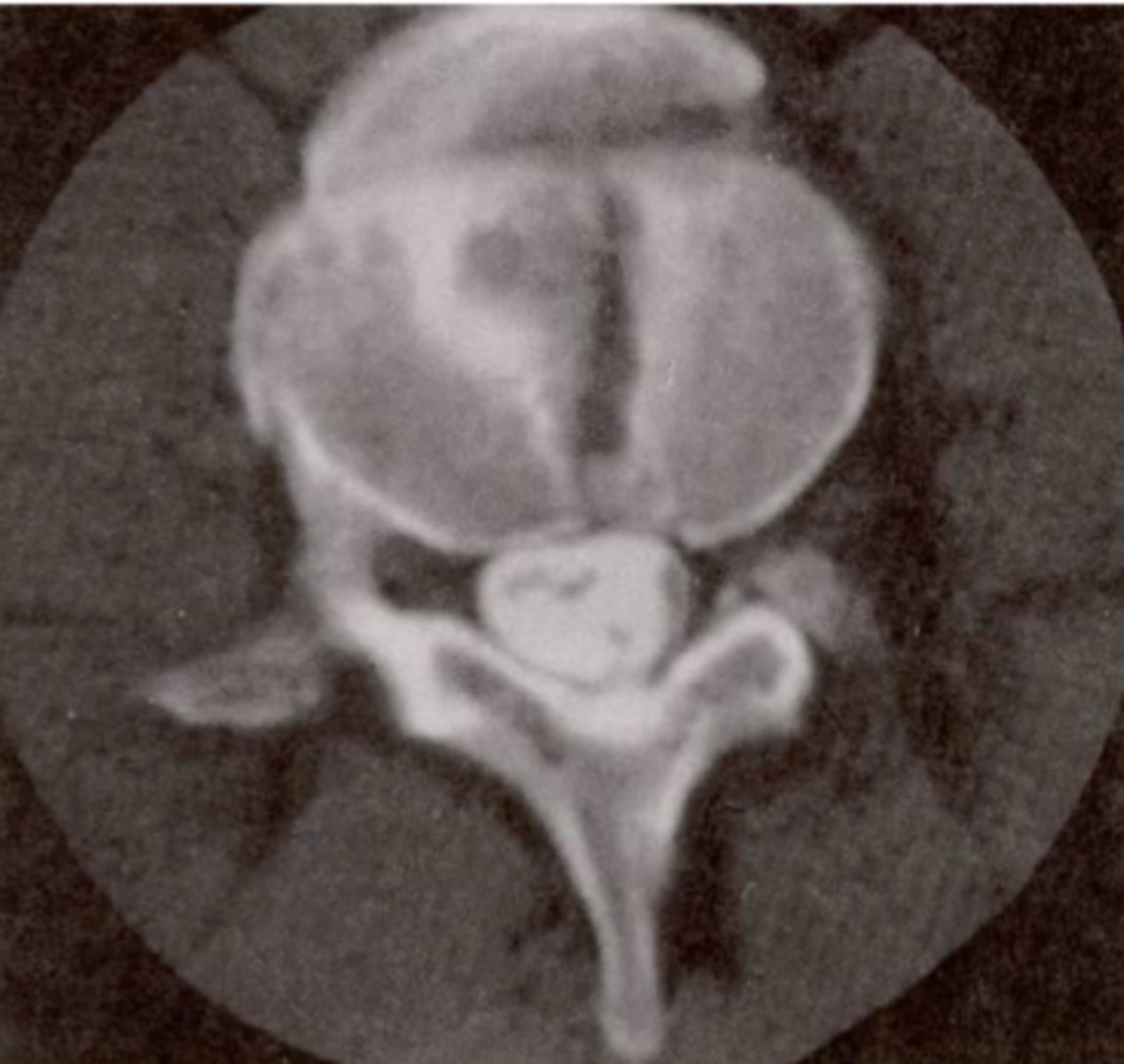 <p>What spinal level is this?</p>