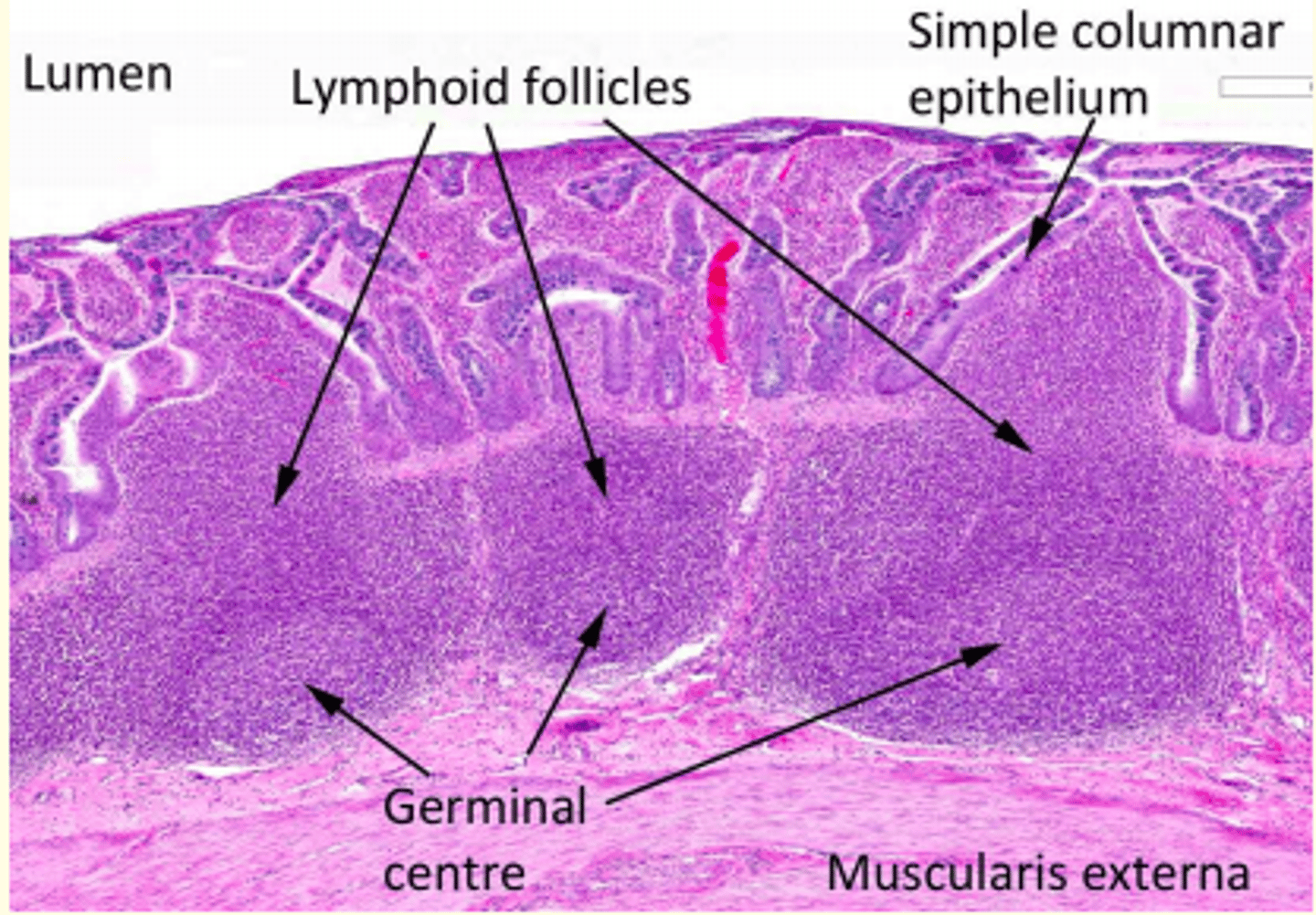 <p>Peyer's patches</p>