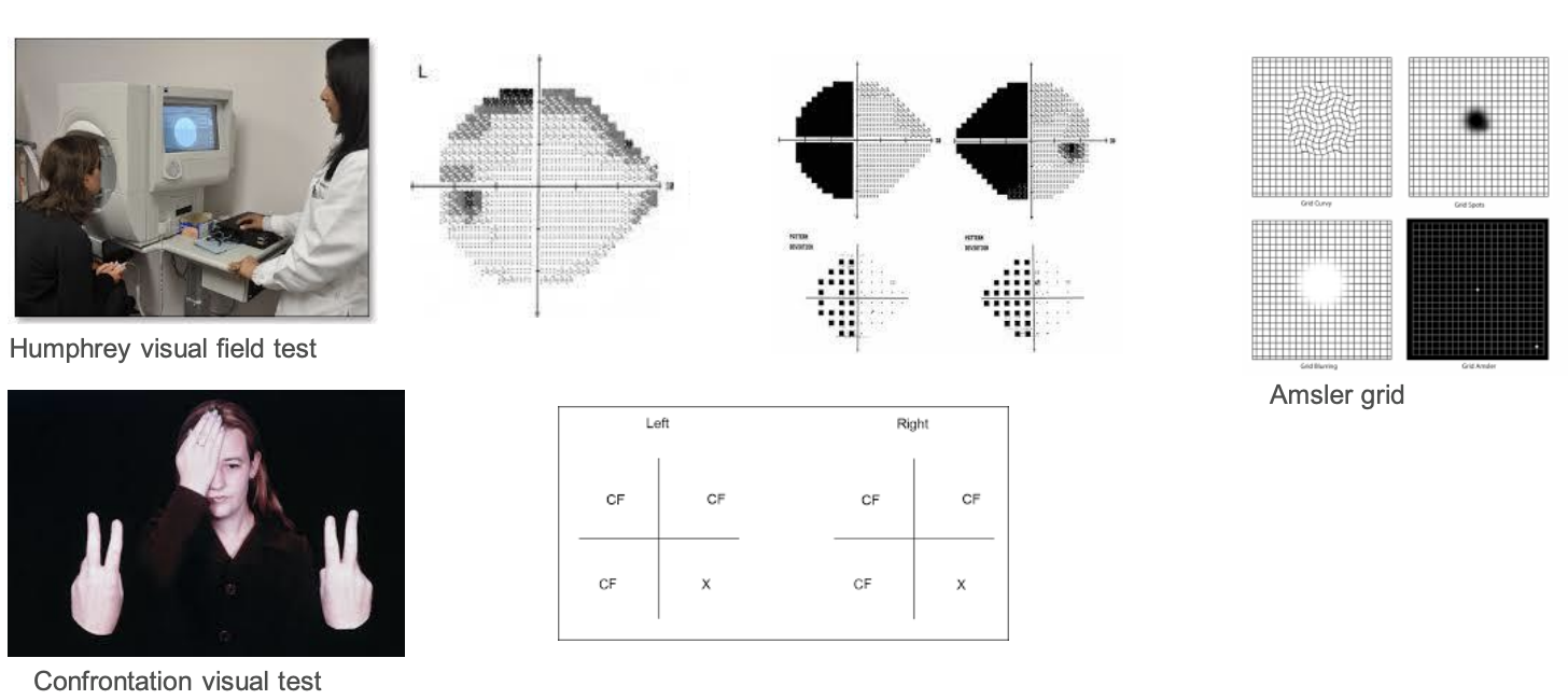 term image