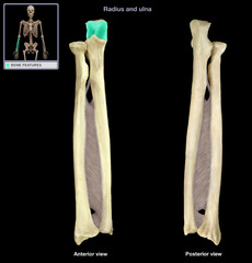 <p>deep area that separates the olecranon and the coronoid process; articulates with the trochlea of the humerus</p>